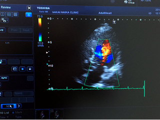 心臓超音波画像診断装置の写真